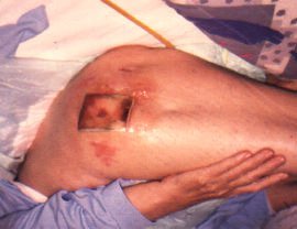LESION (41)  IMAGENES FOTOS